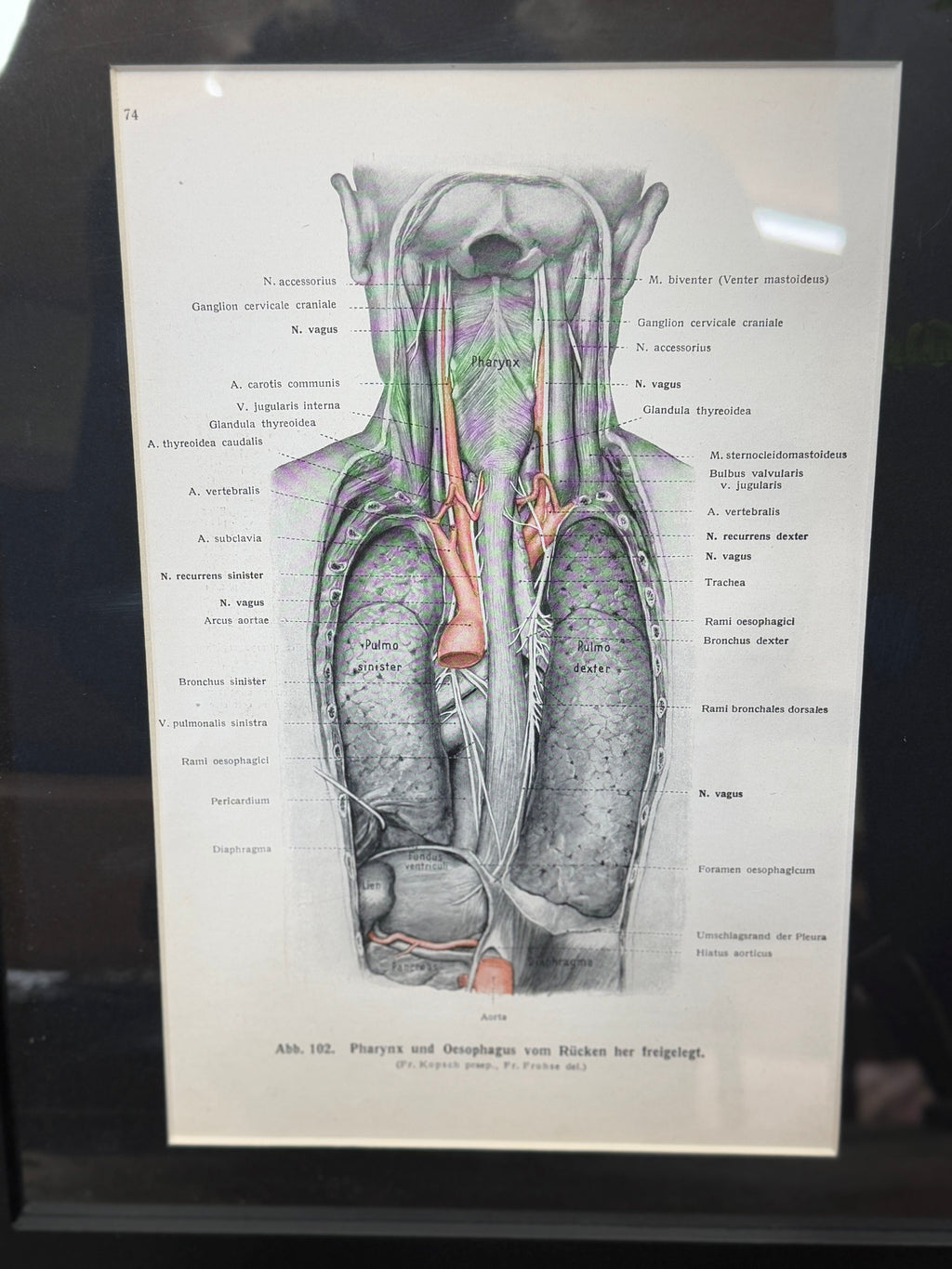 Framed Antique Anatomy Print 1920s Medical Book Plate Wall Art Picture G