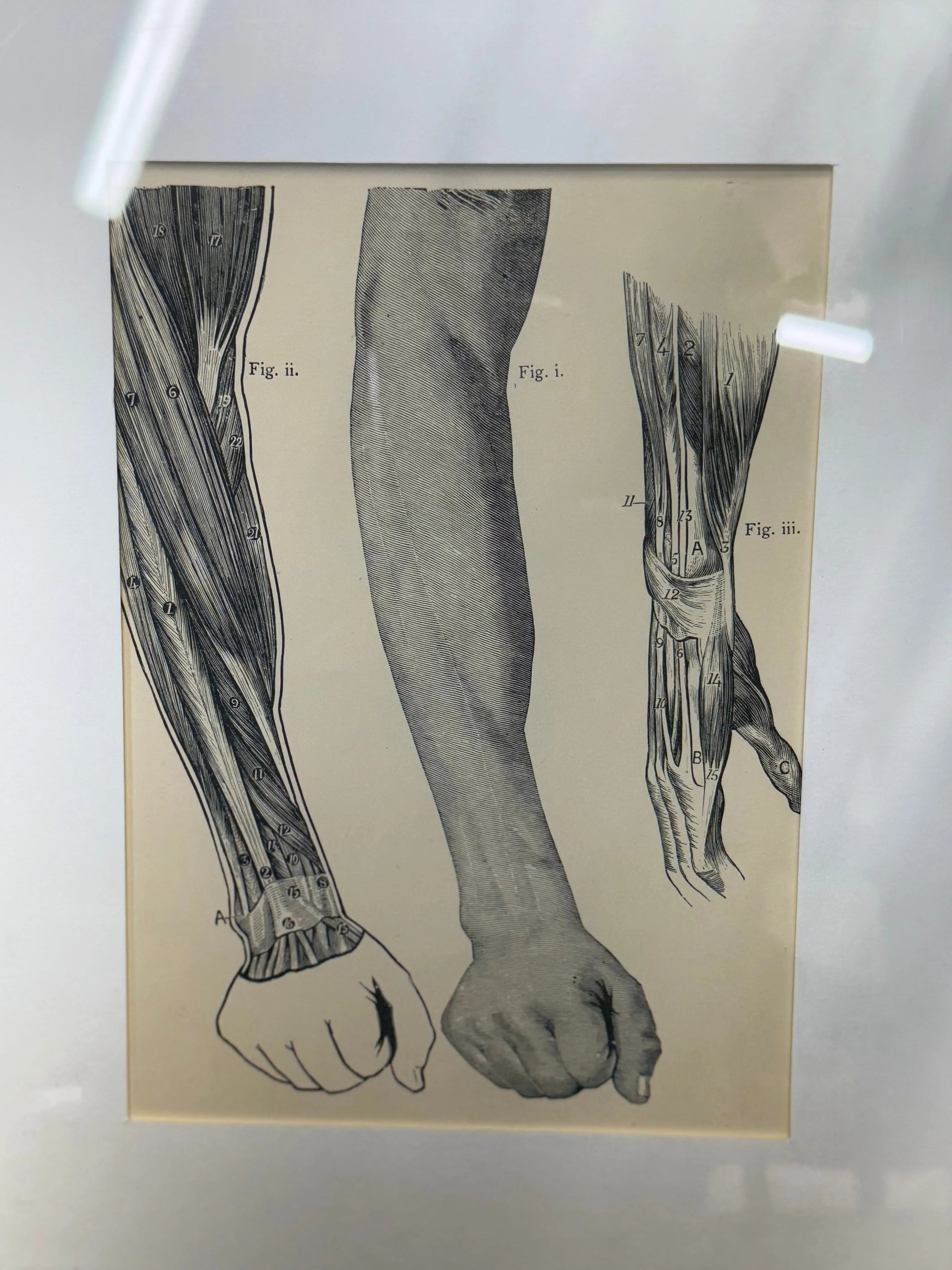 Victorian Anatomy Engraving – Antique Medical Print S