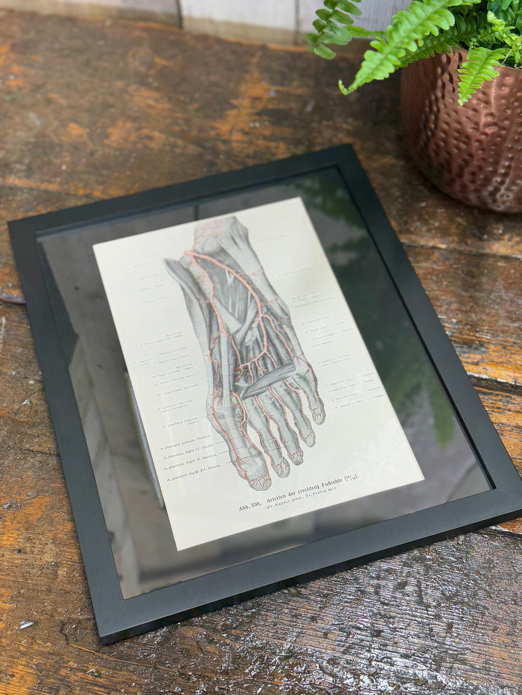 Framed Antique Anatomy Print 1920s Medical Book Plate Wall Art Picture I