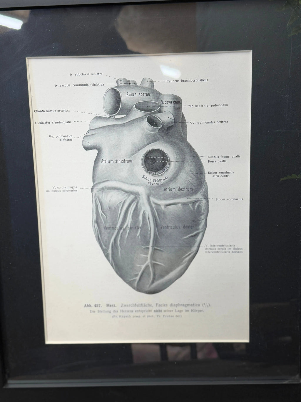 Framed Antique Anatomy Print 1920s Medical Book Plate Wall Art Picture T