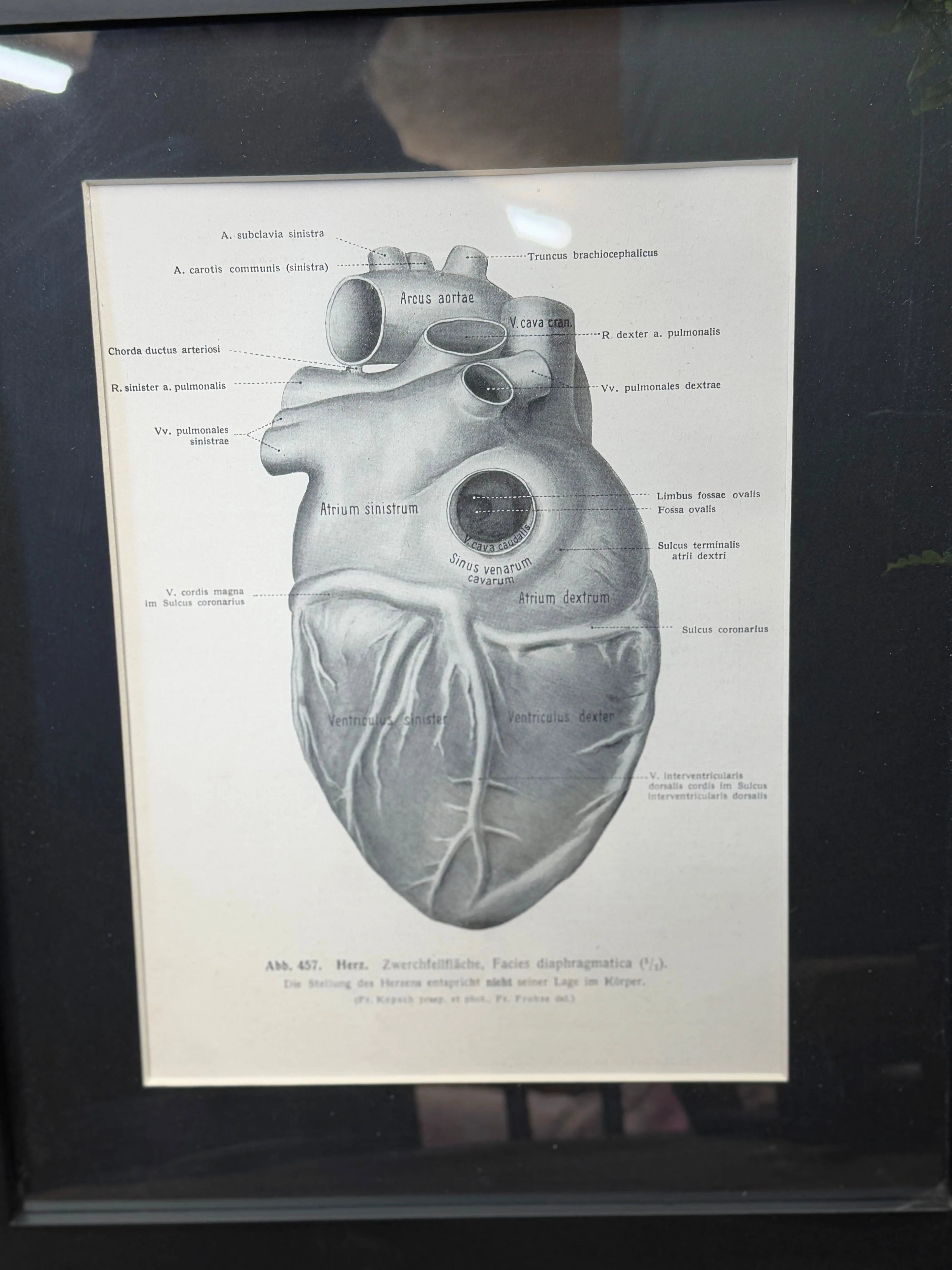 Framed Antique Anatomy Print 1920s Medical Book Plate Wall Art Picture T