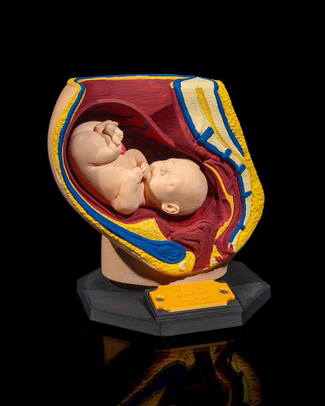 Female Reproduction educational model